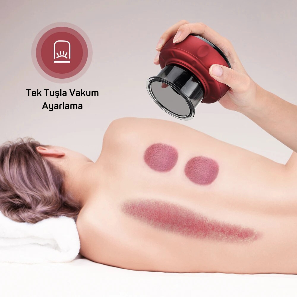 Vein Bene™ - Akıllı Hacamat Kupası