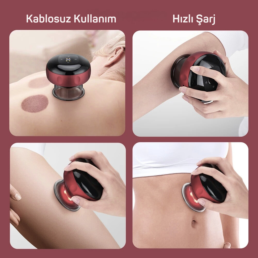 Vein Bene™ - Akıllı Hacamat Kupası
