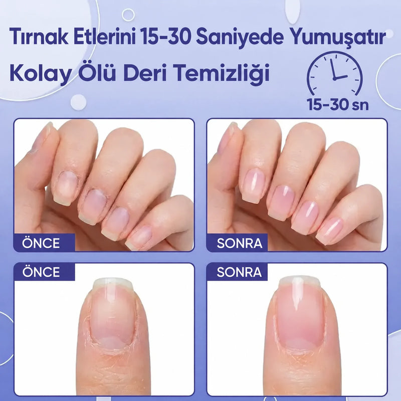Tedarikçinin hazırladığı tırnak çevresi önce ve sonra karşılaştırması